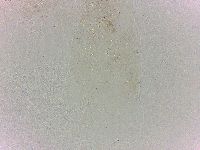 Batillipes minius image