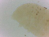 Bryodelphax crossotus image