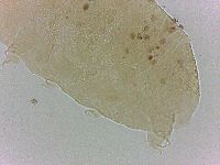 Bryodelphax crossotus image