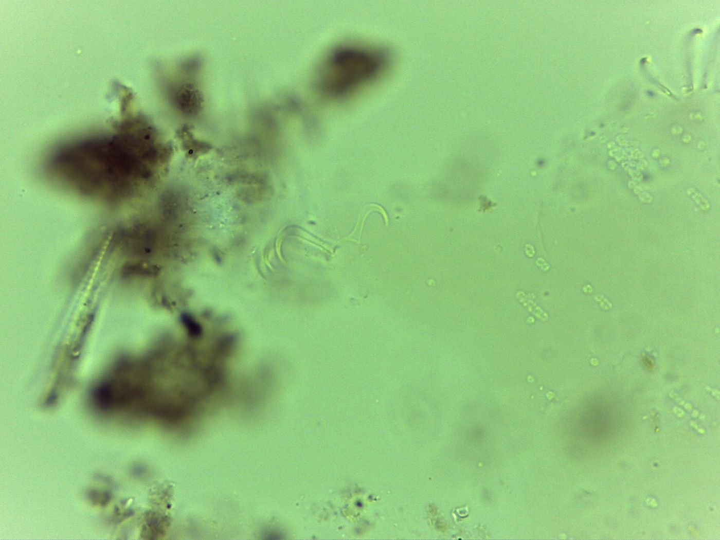 Echiniscoides sigismundi image
