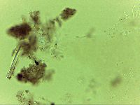 Echiniscoides sigismundi image