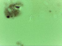 Echiniscoides sigismundi image