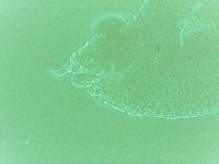 Echiniscoides sigismundi image