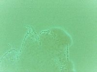 Echiniscoides sigismundi image