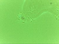 Echiniscoides sigismundi image