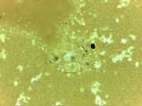 Echiniscoides sigismundi image