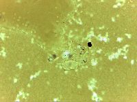 Echiniscoides sigismundi image