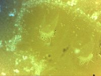Echiniscoides sigismundi image