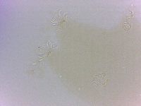 Echiniscoides sigismundi image