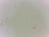 Echiniscoides sigismundi image