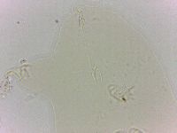 Echiniscoides sigismundi image