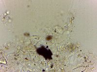Echiniscoides sigismundi image