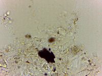 Echiniscoides sigismundi image