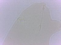 Echiniscoides sigismundi image