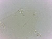 Echiniscoides sigismundi image