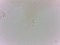 Echiniscoides sigismundi image