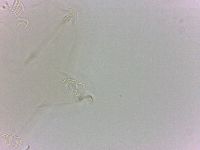 Echiniscoides sigismundi image