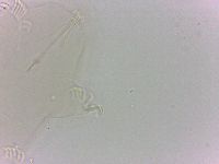 Echiniscoides sigismundi image