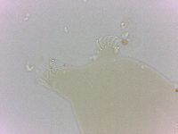Echiniscoides sigismundi image