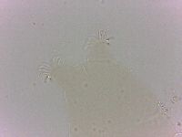 Echiniscoides sigismundi image