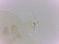 Echiniscoides sigismundi image