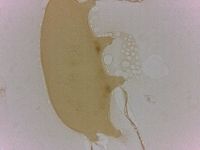 Echiniscoides sigismundi image