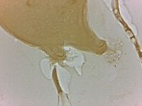 Echiniscoides sigismundi image