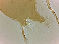 Echiniscoides sigismundi image