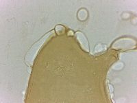 Echiniscoides sigismundi image