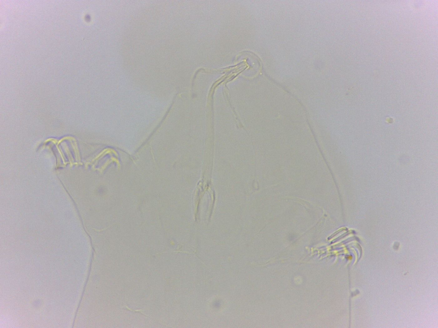 Echiniscoides sigismundi image