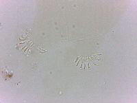 Echiniscoides sigismundi image