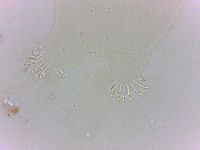 Echiniscoides sigismundi image