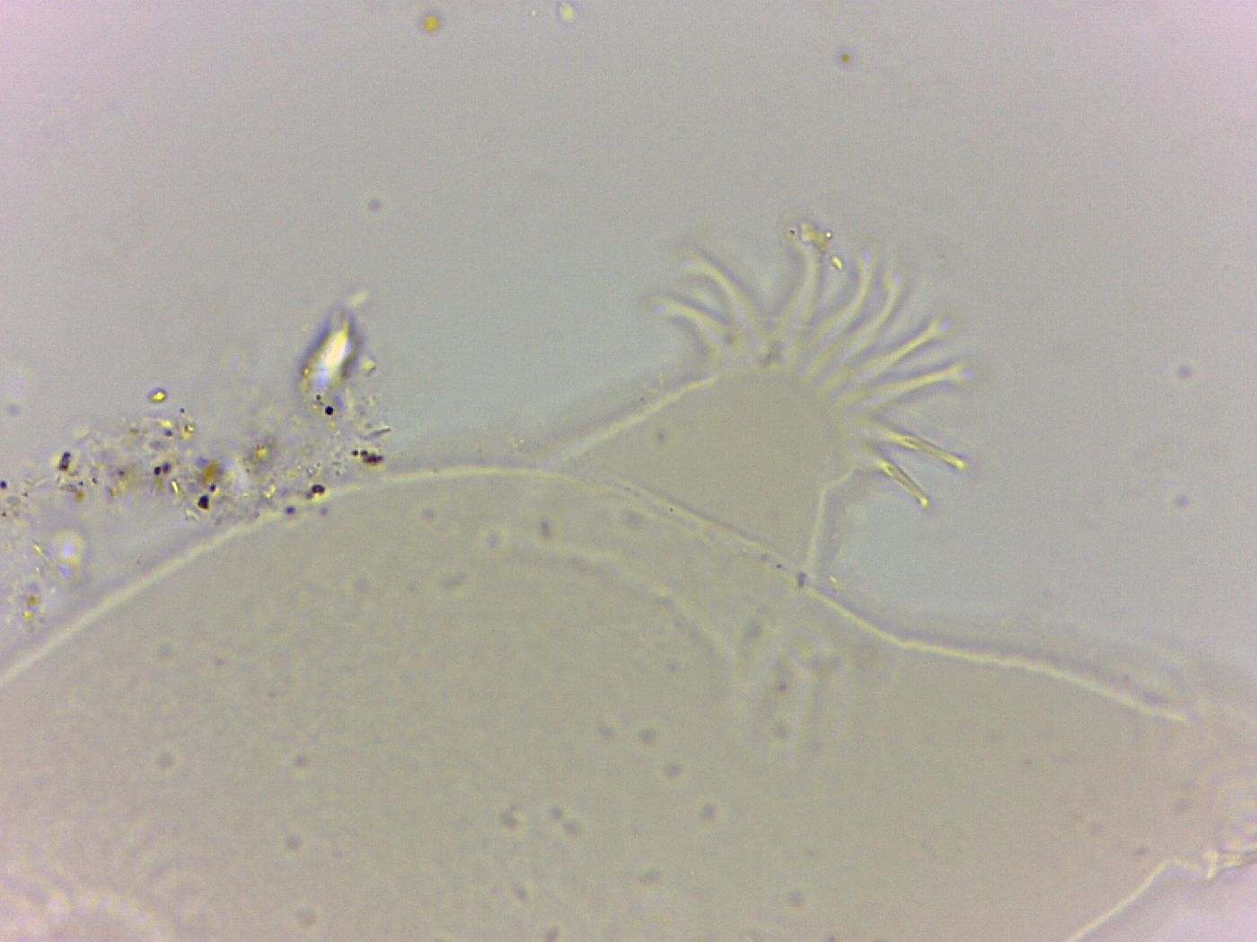 Echiniscoides sigismundi image
