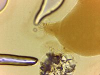 Echiniscoides sigismundi image