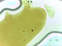 Echiniscoides sigismundi image