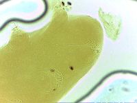 Echiniscoides sigismundi image