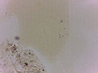 Echiniscoides sigismundi image