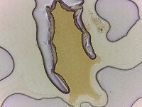 Echiniscoides sigismundi image