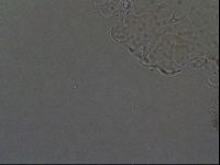 Echiniscoides sigismundi image