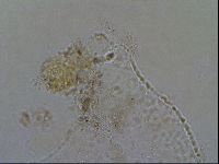 Echiniscoides sigismundi image