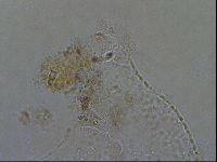 Echiniscoides sigismundi image