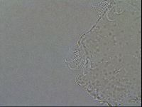 Echiniscoides sigismundi image