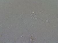 Echiniscoides sigismundi image
