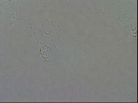 Echiniscoides sigismundi image