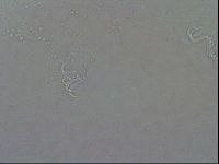 Echiniscoides sigismundi image