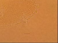 Echiniscoides sigismundi image