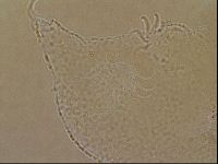 Echiniscoides sigismundi image