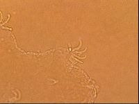 Echiniscoides sigismundi image