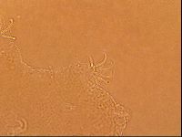 Echiniscoides sigismundi image