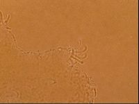 Echiniscoides sigismundi image